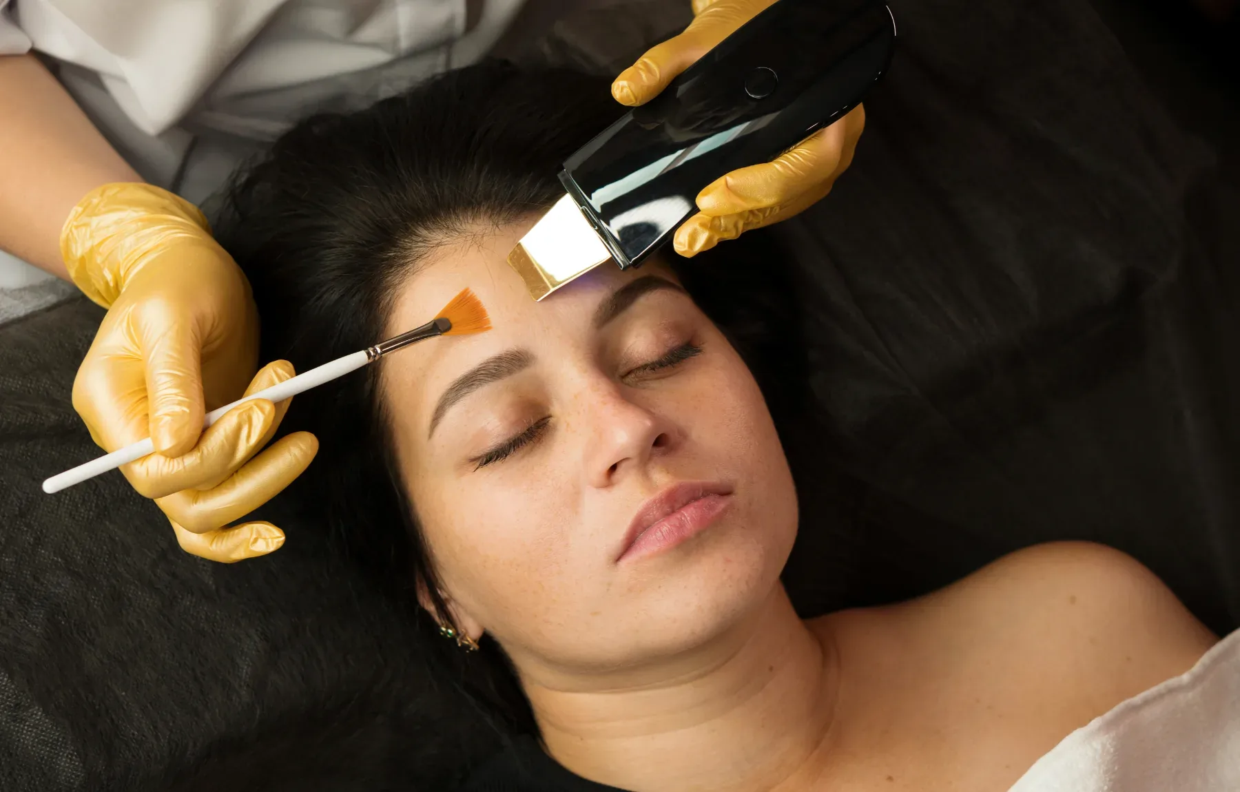 Chemical Peels in Las Vegas, NV That Renew Your Skin
